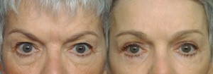 Obtain a More Youthful Appearance