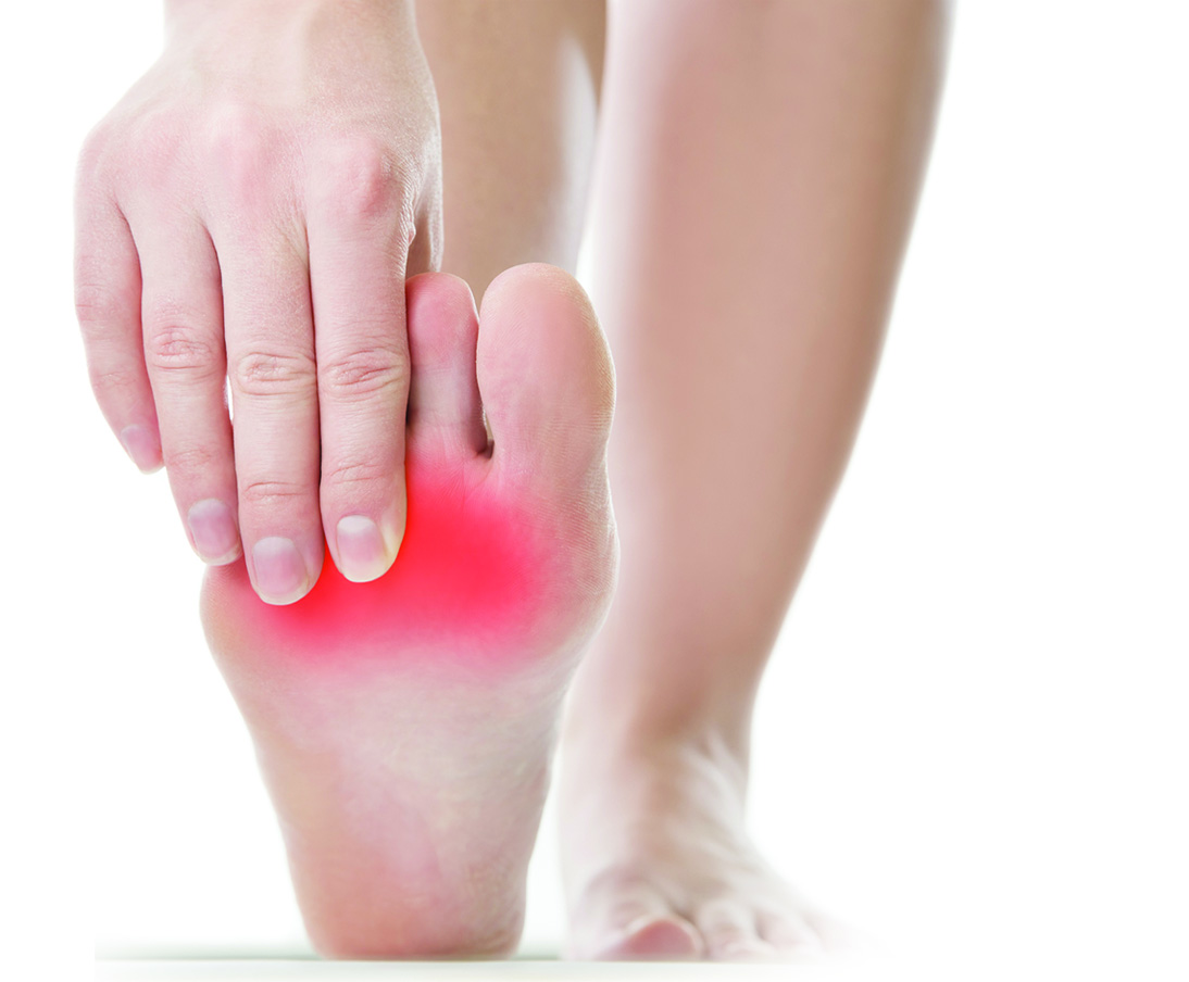 "On Your Feet!" Ball of Foot Pain • Southwest Florida's Health and