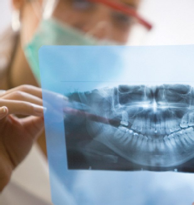 Digital Dental Xray Exams Lower Radiation Exposure • Southwest Florida's Health and Wellness
