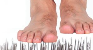 Peripheral Neuropathy